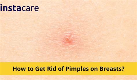 clogged hair follicles on breast|pimple like bumps under breast.